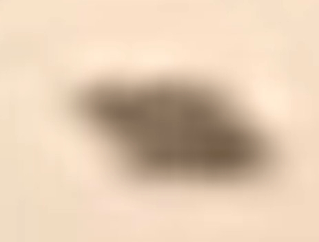 Enlarged