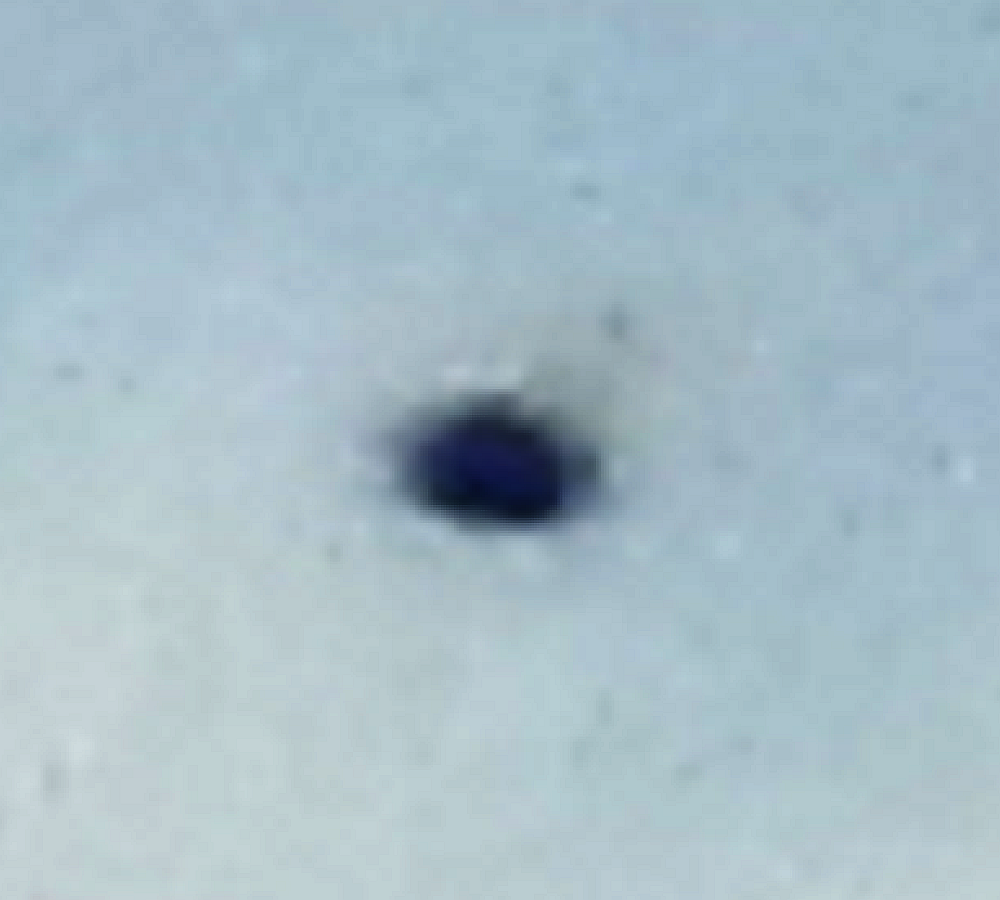 Anomaly