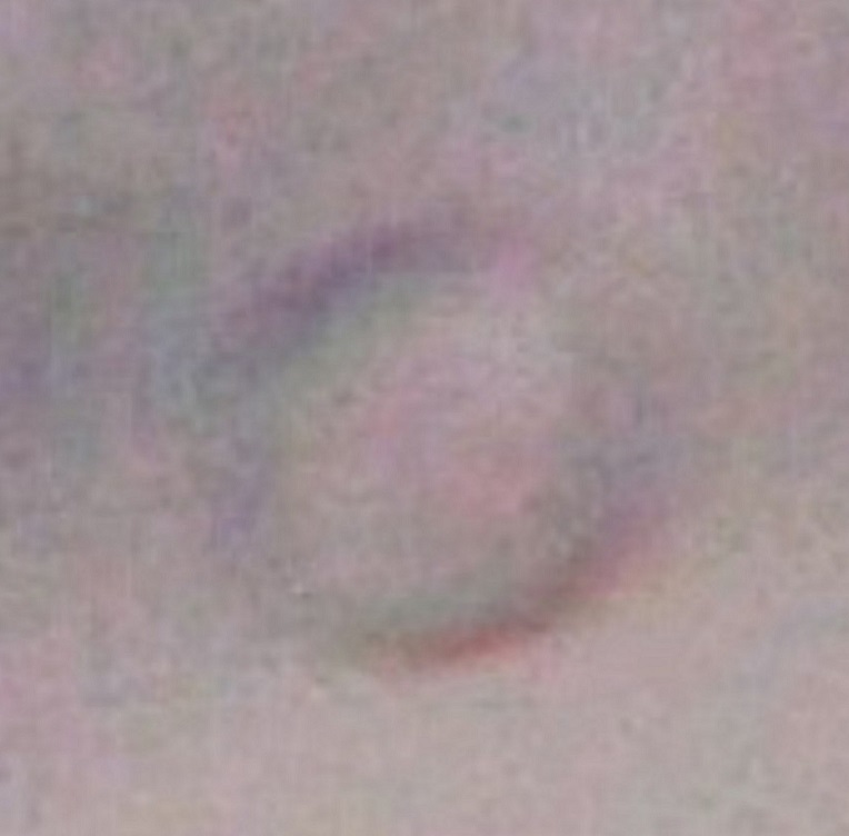 The Ring