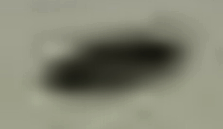 Max enlargement