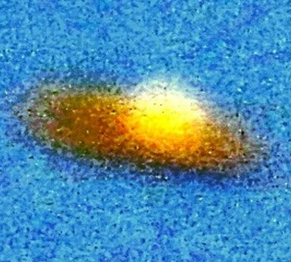 Highly enlarged