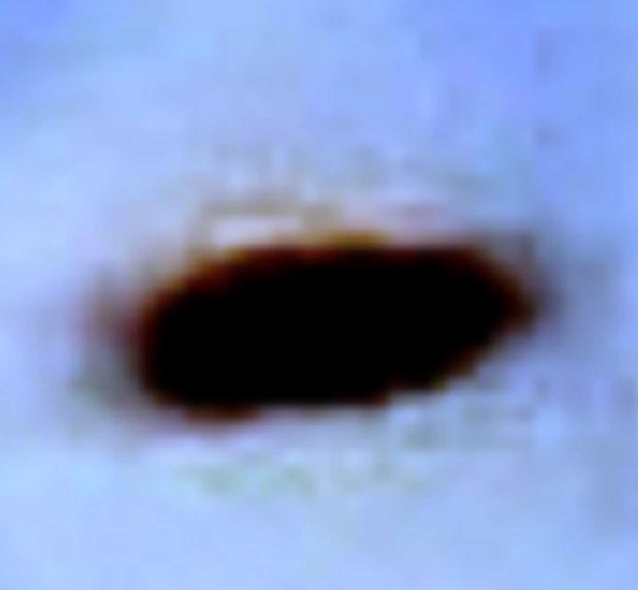 Highly enlarged